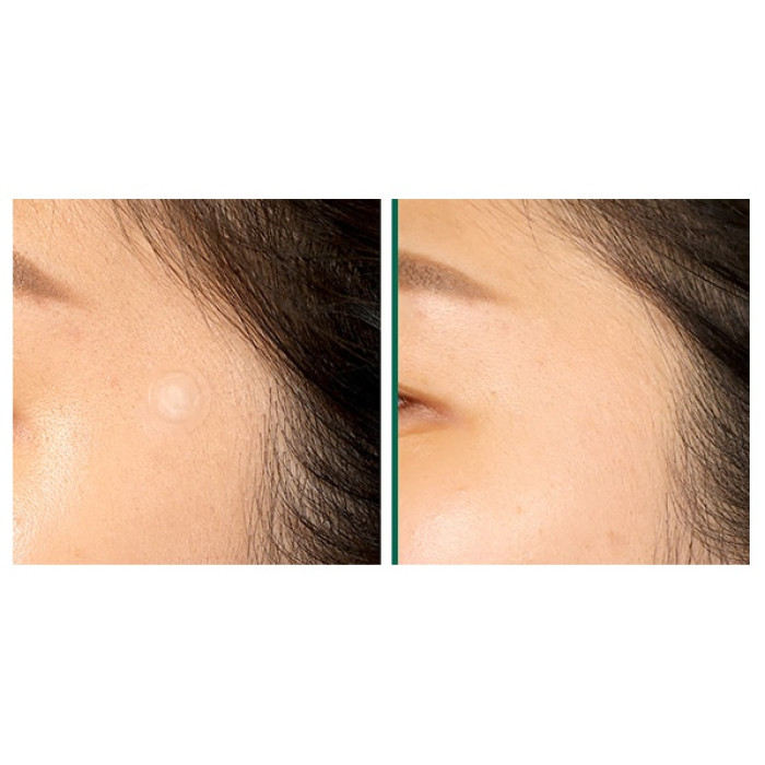 Антибактериальные патчи против прыщей от Some By Mi