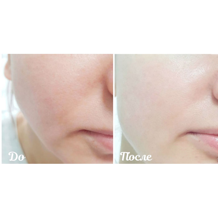 Крем осветляющий с Каламанси от A'pieu