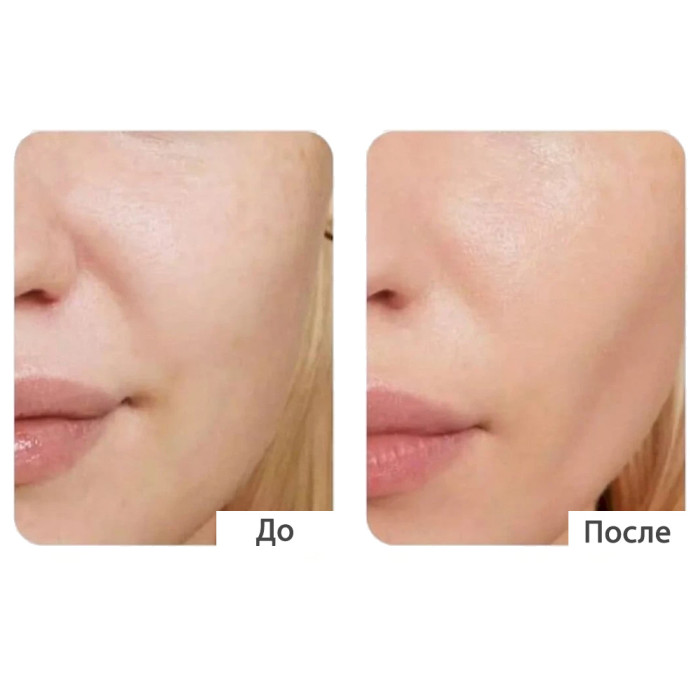 Сыворотка с полинуклеотидами для эластичности от Medi-Peel