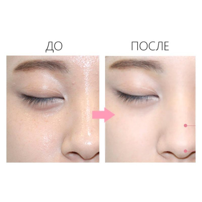 Компактная пудра для проблемной кожи от The Saem